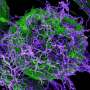 Uganda declares end of 6th Ebola outbreak